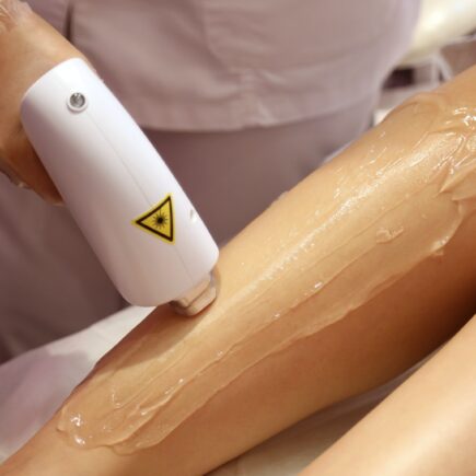 Epilation définitive au laser, risques et précautions